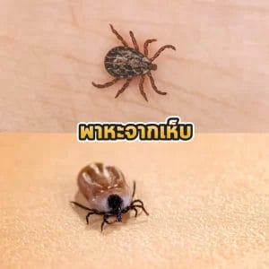 พาหะจากเห็บ